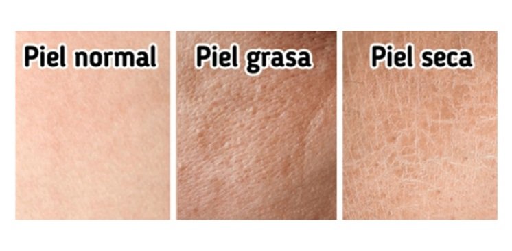 Tipos de piel: ¿Sabes cual es la tuya?